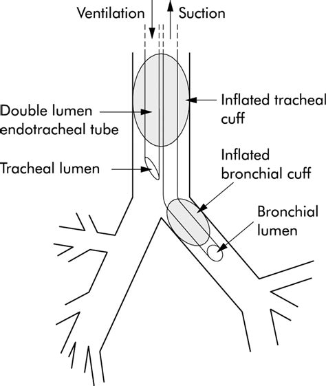 The pulmonary physician in critical care • Illustrative case 7 ...