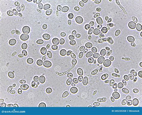 Microscopic View of Yeast Cells Stock Photo - Image of growth ...