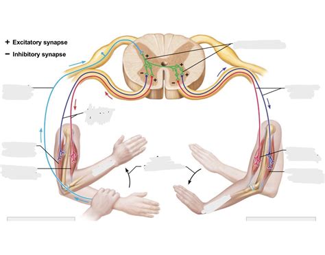Image result for Crossed Extensor Reflex
