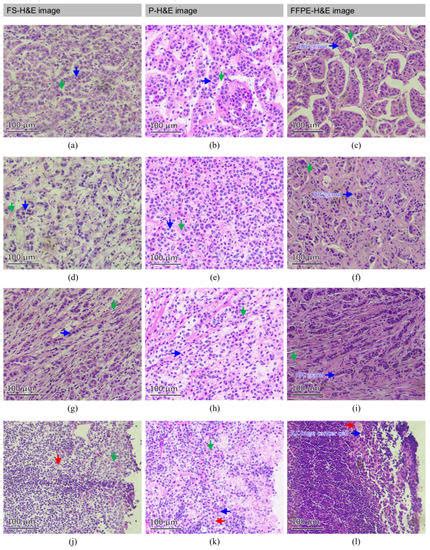 Cancers | Special Issue : Biophotonics and Imaging for Cancer Screening ...