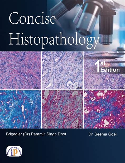 Buy Concise Histopathology (A concise book for BMLT, MBBS and MD ...