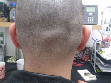 Knot On Back Of Head