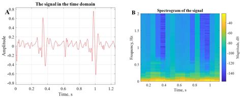 Real-Time Smart-Digital Stethoscope System for Heart Diseases Monitoring