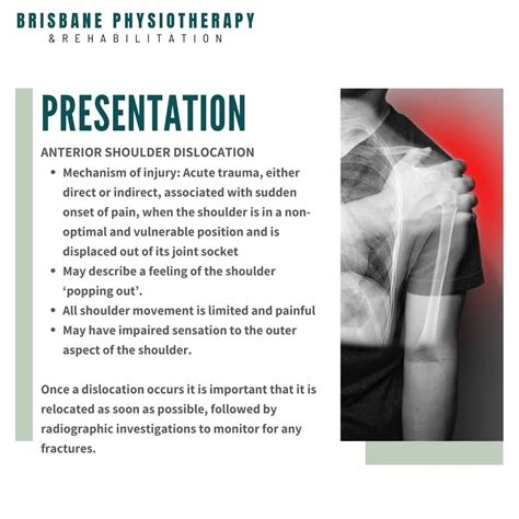 Anterior Shoulder Dislocation Mechanism Of Injury