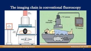 Image result for Conventional Fluoroscopy