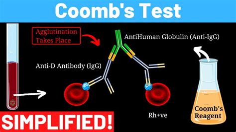 Image result for Coombs Reagent