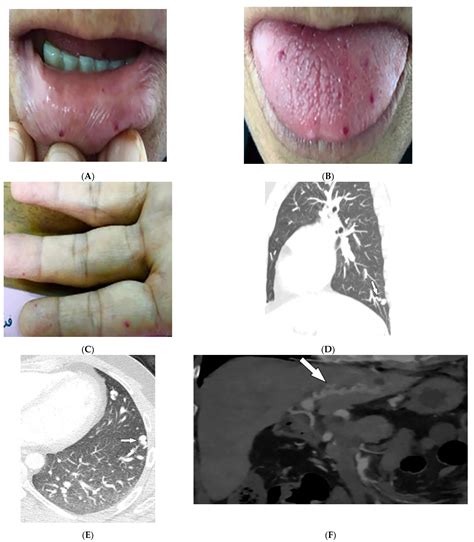 Imaging More than Skin-Deep: Radiologic and Dermatologic Presentations ...