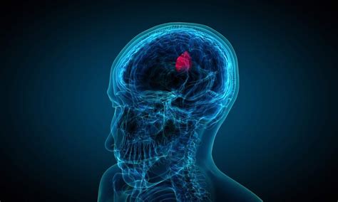 Late-line treatment with Bevacizumab alone or in combination with ...