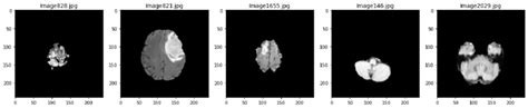 Image result for Brain Tumor Detection Using Machine Learning