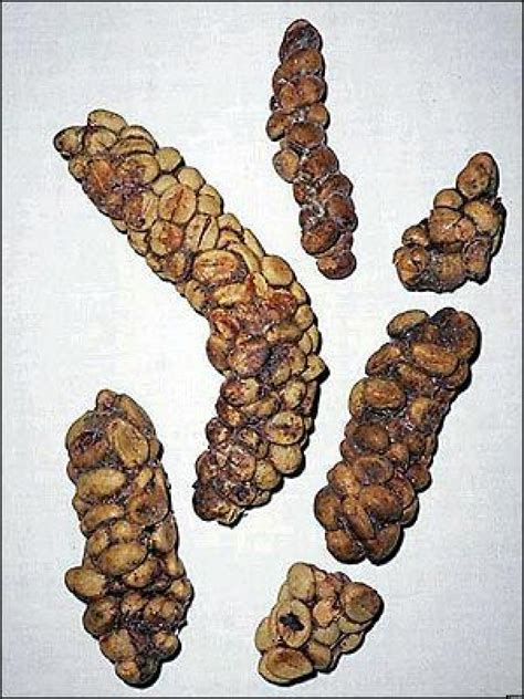 Coffee Grain Poop