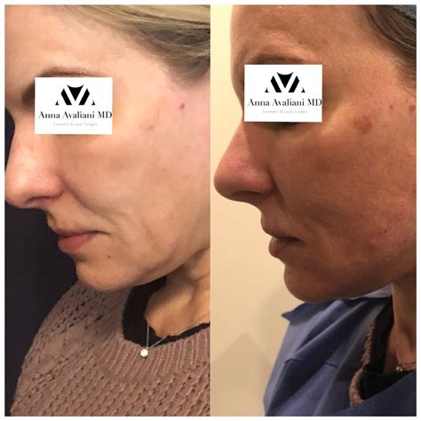 Image result for Face Threads