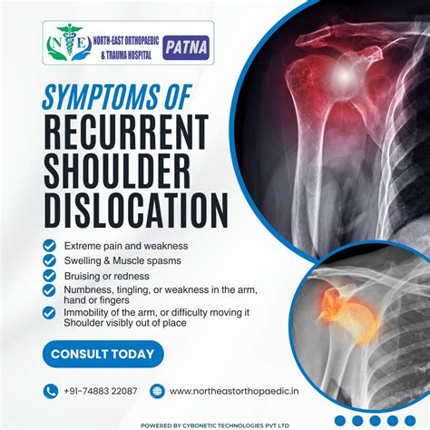 🏥 Recognizing the Symptoms of Recurrent Shoulder Dislocation is Crucial! | North East ...