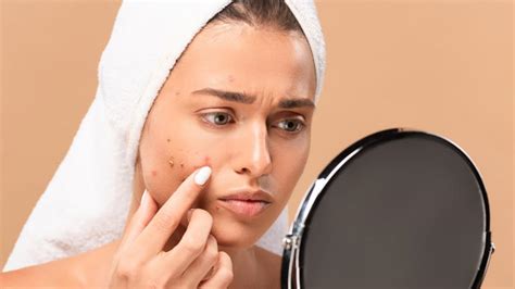 How to improve skin texture? 11 tips to follow