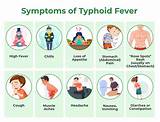 Difference between symptoms of dengue and typhoid