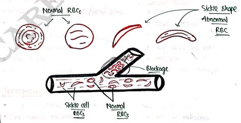 Pathophysiology Unit 3 Notes - 2nd Semester B Pharmacy | Carewell Pharma