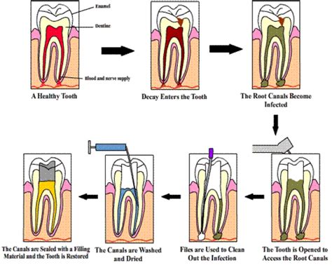 Treatment Rendered - Oradent