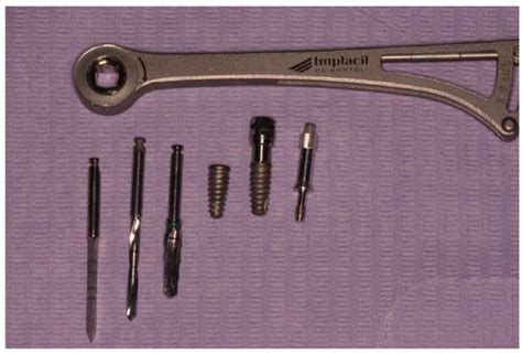 Osseodensification Drilling vs. Standard Protocol of Implant Site ...