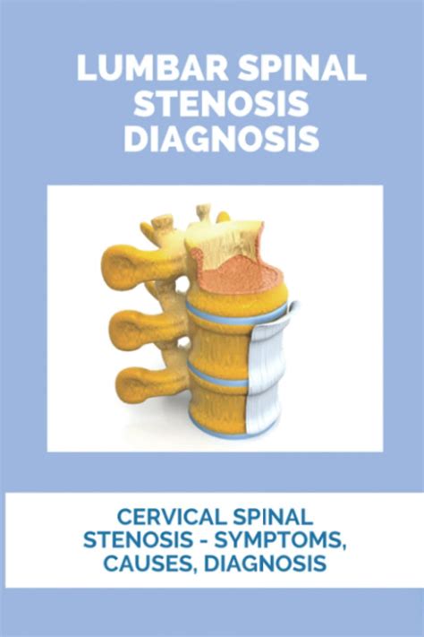 Buy Lumbar Spinal Stenosis Diagnosis: Cervical Spinal Stenosis ...