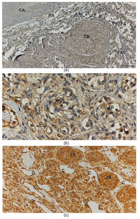 A Developmental Perspective on Paragangliar Tumorigenesis