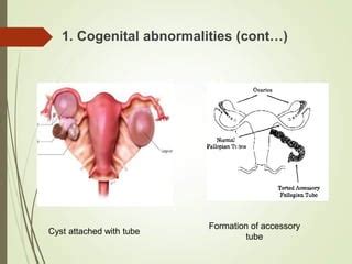 Image result for Female Reproductive System Disorders