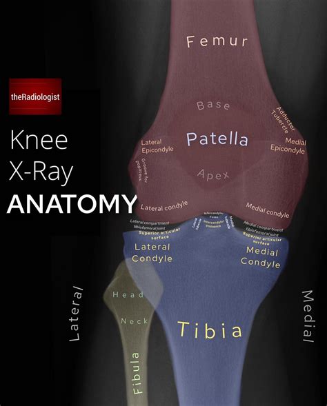 Pin by Jennifer Zuberbier on Athletic Training | Medical radiography, Radiology student, Medical ...
