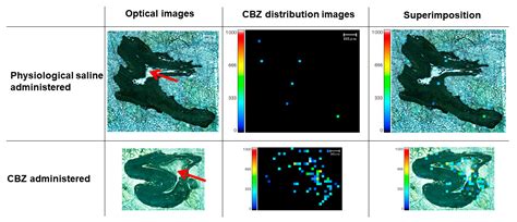 Application of Teeth in Toxicological Analysis of Decomposed Cadavers ...