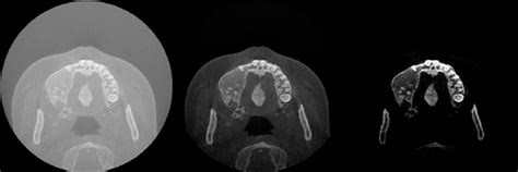 Image result for Window Level Wide