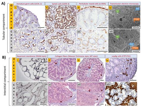 Generation of a Highly Biomimetic Organoid, Including Vasculature ...