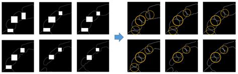 Tooth Segmentation of 3D Scan Data Using Generative Adversarial Networks