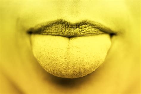 Can Cancer Cause A Black Tongue at Lachlan Legge blog