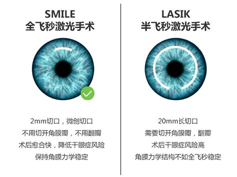 全飞秒 VS 半飞秒，杭州眼科医生告诉你两种术式区别？_全民健康网