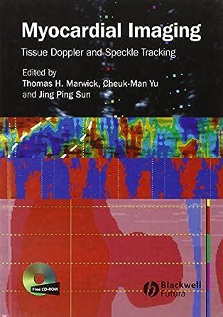 Buy Myocardial Imaging: Tissue Doppler and Speckle Tracking Book Online ...