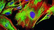Wie Sie Gewebeproben für die Immunfluoreszenz-Mikroskopie vorbereiten ...