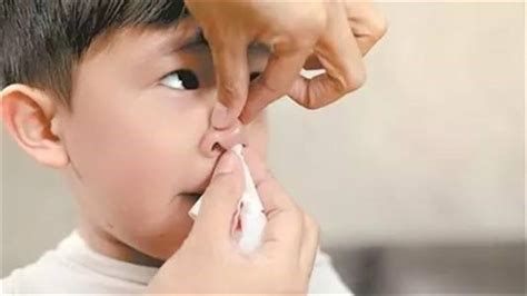 小孩经常流鼻血怎么回事，应该怎么办 - 育儿知识