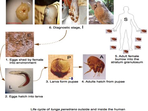 Image result for Jigger Bug Parasite