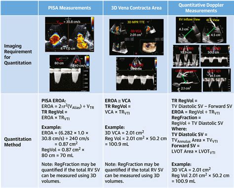 Tricuspid Valve Academic Research Consortium Definitions for Tricuspid ...
