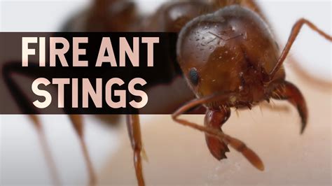 What Do Fire Ants Do To Humans at Sean Swick blog