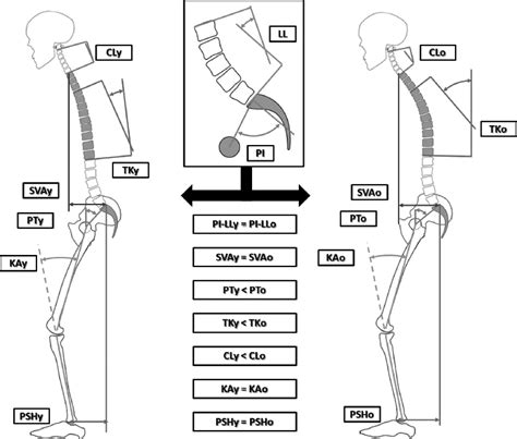 Image result for Compensatory Loading