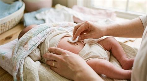Umbilical Cord Care: Normal vs Infected Umbilical Cord Sign