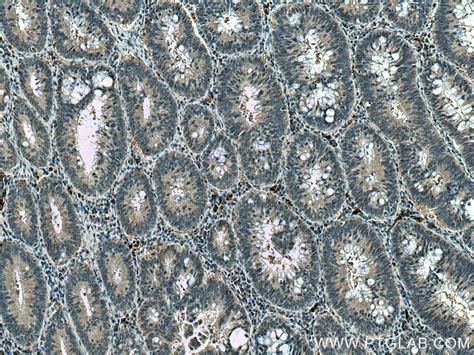 CDCA5 antibody (67418-1-Ig) | Proteintech