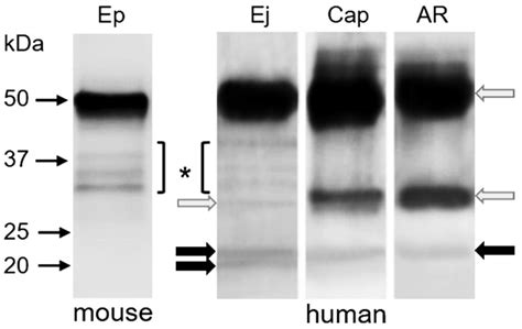 CD9 and CD81 Interactions and Their Structural Modelling in Sperm Prior ...