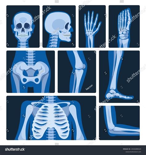 How To Draw Hand X Ray