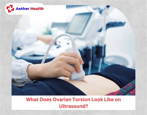 Ovarian Torsion Ultrasound: Key Signs, Findings & Diagnostic Accuracy