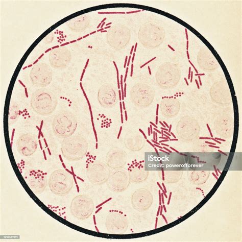 Microscopic View Of Human Blood Cells And Proteus Vulgaris Bacteria ...