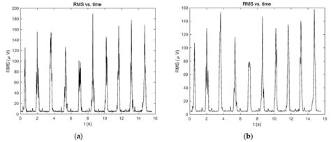 Processing of EMG Signals with High Impact of Power Line and Cardiac ...