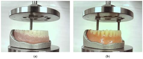 Ranking Technologies of Additive Manufacturing of Removable Complete ...