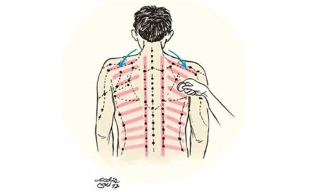 Kerokan - JungleKey.in Image #50