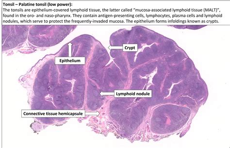 Tonsil – Normal Histology – NUS Pathweb :: NUS Pathweb