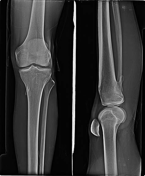 Services || Nalanda Bone & Spine Centre