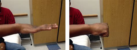 Image result for Extensor Digitorum Communis Surgery